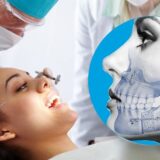 اخر التطورات في زراعة الأسنان