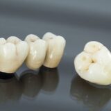 افضل دكتور زراعة اسنان في عمان