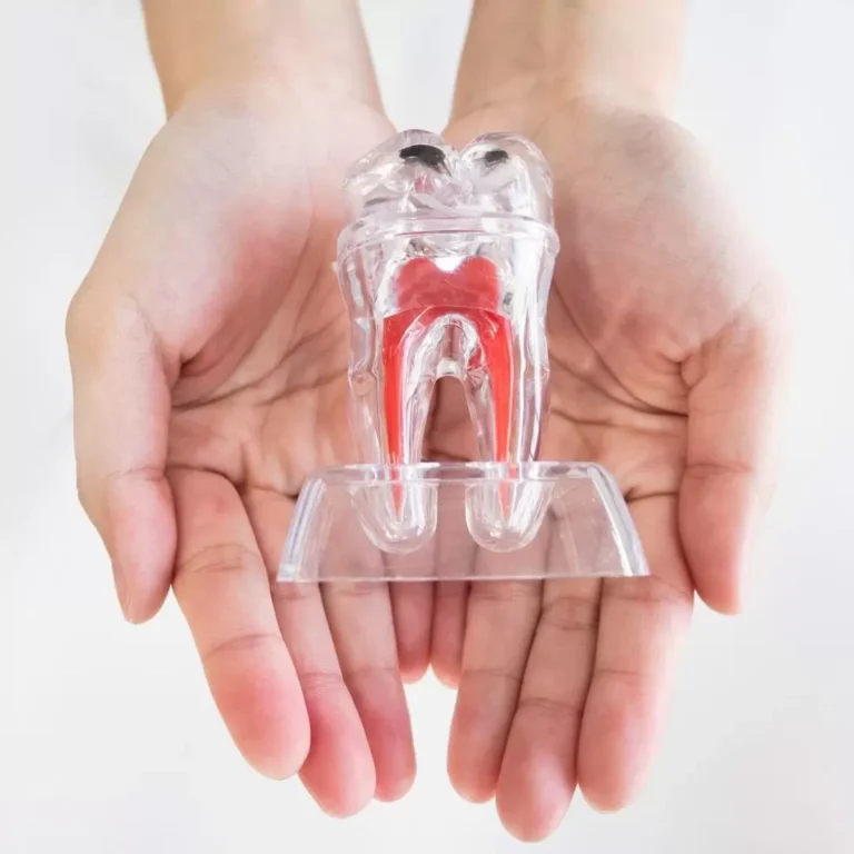 زراعة الأسنان في الأردن