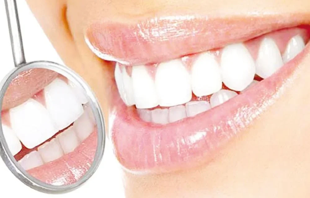 تجميل الأسنان