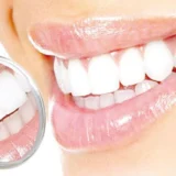 تجميل الأسنان